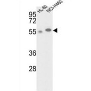 N-Acetylgalactosamine Kinase (GALK2) Antibody