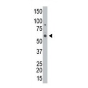 N-Acetylgalactosamine Kinase (GALK2) Antibody