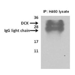 Deoxycytidine Kinase (DCK) Antibody