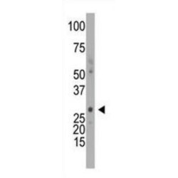 Deoxycytidine Kinase (DCK) Antibody