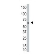 NIMA Related Kinase 8 (NEK8) Antibody