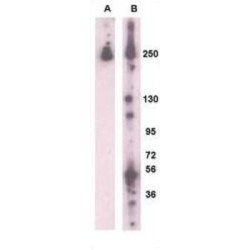 Leucine-Rich Repeat Serine/threonine-Protein Kinase 2 (PARK8) Antibody