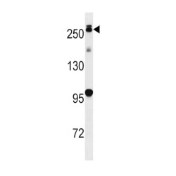 Leucine-Rich Repeat Serine/threonine-Protein Kinase 2 (PARK8) Antibody