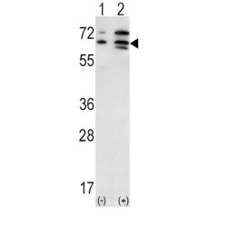 Activin A Receptor Type 2A (ACVR2A) Antibody