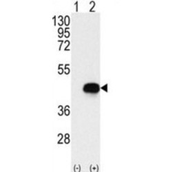 Branched Chain Alpha-Ketoacid Dehydrogenase Kinase (BCKDK) Antibody