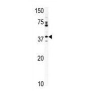 Cyclin-Dependent Kinase 20 (CDK20) Antibody