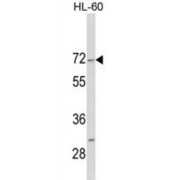 Homeodomain-Interacting Protein Kinase 4 (HIPK4) Antibody