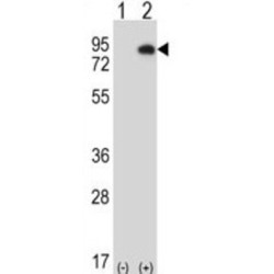 Homeodomain-Interacting Protein Kinase 4 (HIPK4) Antibody