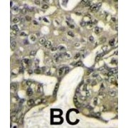 RAC-Alpha Serine/threonine-Protein Kinase (AKT1) Antibody