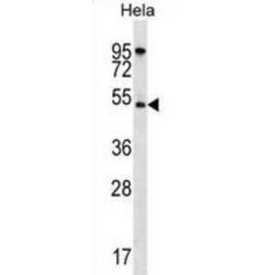 RAC-Alpha Serine/threonine-Protein Kinase (AKT1) Antibody