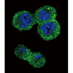 RAC-Alpha Serine/threonine-Protein Kinase (AKT1) Antibody