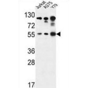 RAC-Alpha Serine/threonine-Protein Kinase (AKT1) Antibody