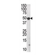 MAP Kinase-Interacting Serine/Threonine-Protein Kinase 1 (MKNK1) Antibody