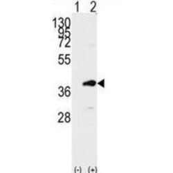 Lymphokine-Activated Killer T-Cell-Originated Protein Kinase (PBK) Antibody