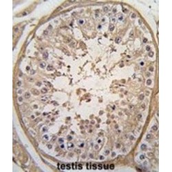 Phosphoglycerate Kinase 2 (PGK2) Antibody