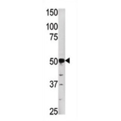 Phosphoglycerate Kinase 2 (PGK2) Antibody