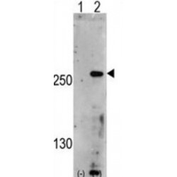 Phosphoinositide Kinase, FYVE-Type Zinc Finger Containing (PIP5K3) Antibody