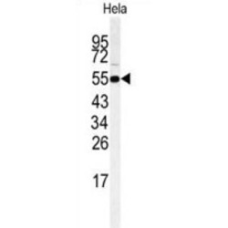 Receptor Interacting Serine Threonine Kinase 3 (RIPK3) Antibody