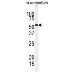 Receptor Interacting Serine Threonine Kinase 3 (RIPK3) Antibody