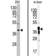 Aflatoxin B1 Aldehyde Reductase Member 2 (AKR7A2) Antibody