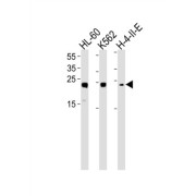 High Mobility Group Protein B2 (HMGB2) Antibody