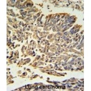 Heat Shock Protein 27 (HSP27) Antibody