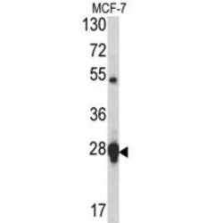 Heat Shock Protein 27 (HSP27) Antibody