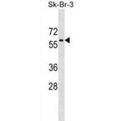 5'-AMP-Activated Protein Kinase Catalytic Subunit Alpha-1 (PRKAA1) Antibody