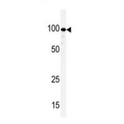 KSR Antibody