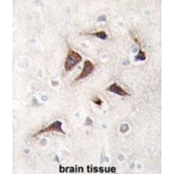 Calcium/calmodulin Dependent Protein Kinase II Delta (CAMK2D) Antibody