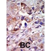 Leucine-Zipper Protein Kinase (ZPK) Antibody