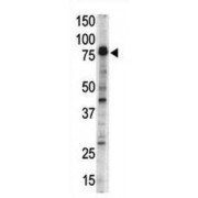 Doublecortin-Like And CAM Kinase-Like 1 (DCAMKL1) Antibody