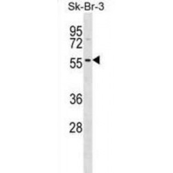 DAP Kinase-Related Apoptosis-Inducing Protein Kinase 1 (DRAK1) Antibody