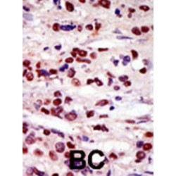 DAP Kinase-Related Apoptosis-Inducing Protein Kinase 2 (DRAK2) Antibody