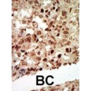 Mitogen-Activated Protein Kinase 11 (MAPK11) Antibody