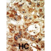 Mitogen-Activated Protein Kinase 12 (MAPK12) Antibody