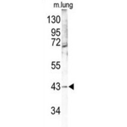 Mitogen-Activated Protein Kinase 12 (MAPK12) Antibody