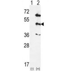 Mitogen-Activated Protein Kinase 12 (MAPK12) Antibody