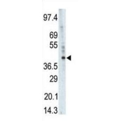 Phosphorylase Kinase Catalytic Subunit Gamma 1 (PHKG1) Antibody