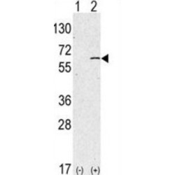 Sphingosine Kinase 1 (SPHK1) Antibody