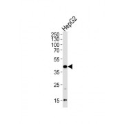 Sphingosine Kinase 1 (SPHK1) Antibody