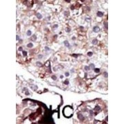 Sphingosine Kinase 2 (SPHK2) Antibody