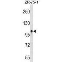 Serine/Threonine Kinase 31 (STK31) Antibody