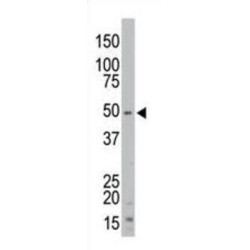 Serine/threonine Kinase 35 (STK35) Antibody