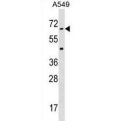 Serine/threonine Kinase 35 (STK35) Antibody