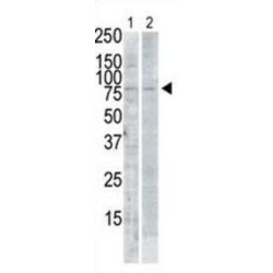 Serine/Threonine-Protein Kinase PLK2 (PLK2) Antibody