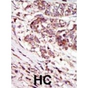 Calcium/calmodulin Dependent Protein Kinase IG (CAMK1G) Antibody