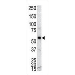 Calcium/calmodulin Dependent Protein Kinase IG (CAMK1G) Antibody