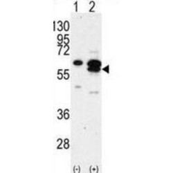 Calcium/calmodulin Dependent Protein Kinase IG (CAMK1G) Antibody