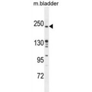 Rapamycin-Insensitive Companion of mTOR (RICTOR) Antibody